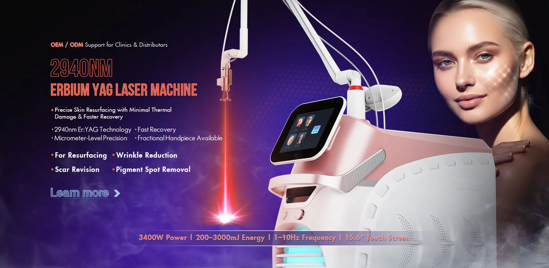 Why SANHE Laser’s 2940nm Er:YAG Platform Has Built Strong Market Recognition