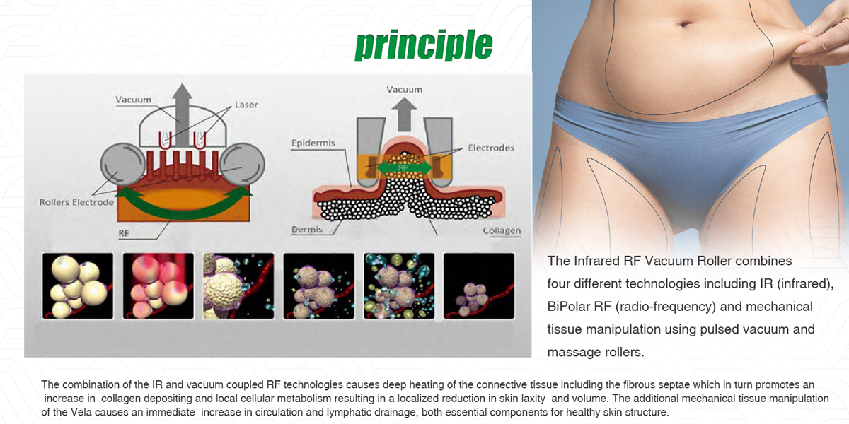 SANHE Body Roller Beauty Machine for Sale.jpg SANHE Body Roller Beauty Machine for Sale.jpg