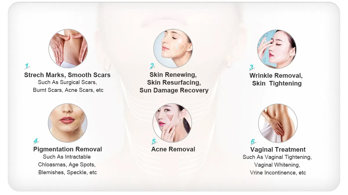 Why Some Clinics Use Fractional CO2 Before Tattoo Removal — and Why Picosecond Laser Still Leads the Business Case